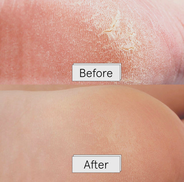 Dr. Pedicure Foot Peeling Mask